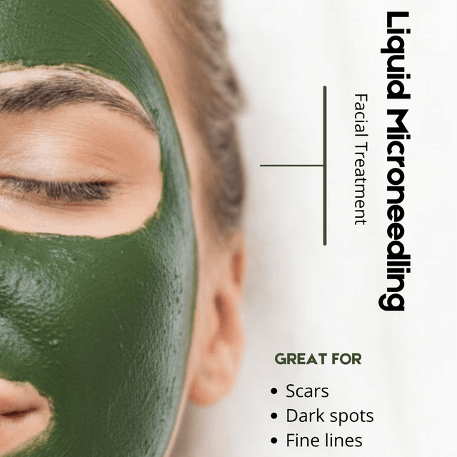3 Liquid Microneedling Series at Sapphire Beauty Studio in Cedar Rapids, IA